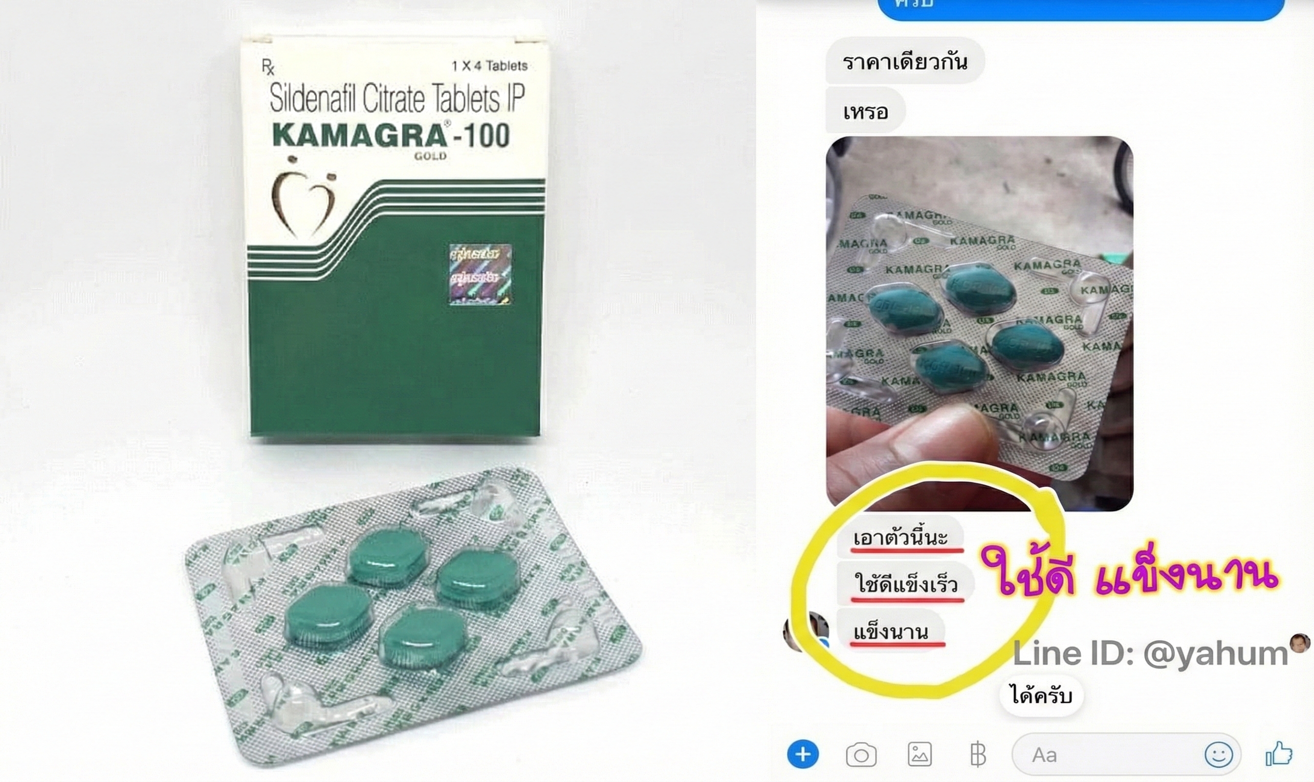 แชทรีวิว Kamagra 100mg Gold ใช้ดี แข็งนาน